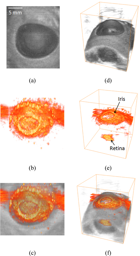 Volume-rendered reconstructed three dimensional (a, d) ultrasound, (b, e) photoacoustic, and (c, f) combined images of the porcine eye.