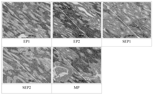 Histological changes of the kidney in Korean rockfish Sebastes schlegeli fed the experimental diets for 11 weeks (H&E stain, ×400). EP; extruded pellet, SEP; Soft extruded pellet, MP; raw fish-based moist pellet.