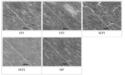 Histological changes of the spleen in Korean rockfish Sebastes schlegeli fed the experimental diets for 11 weeks (H&E stain, ×400). EP; extruded pellet, SEP; Soft extruded pellet, MP; raw fish-based moist pellet.