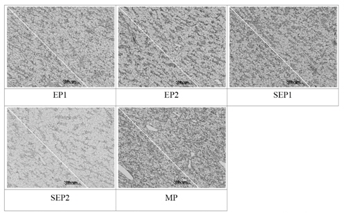 Histological changes of the liver of the Rockfish, Sebastes schlegeli at final feeding by different SEP, EP and MP diets (H&E stain, ×400). EP; extruded pellet, SEP; Soft extruded pellet, MP; raw fish-based moist pellet.