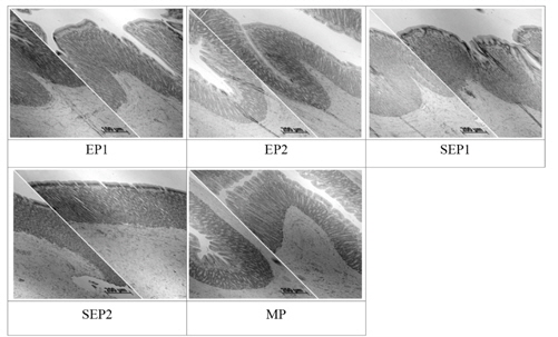 Histological changes of the stomach in Korean rockfish Sebastes schlegeli fed the experimental diets for 11 weeks (H&E stain,×400). EP; extruded pellet, SEP; Soft extruded pellet, MP; raw fish-based moist pellet.