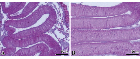 Histopathological feature of digestive gland in sea squirt Halocynthia roretzi by the effect of starvation. A: 8±0.5℃. B: 15±0.5℃.