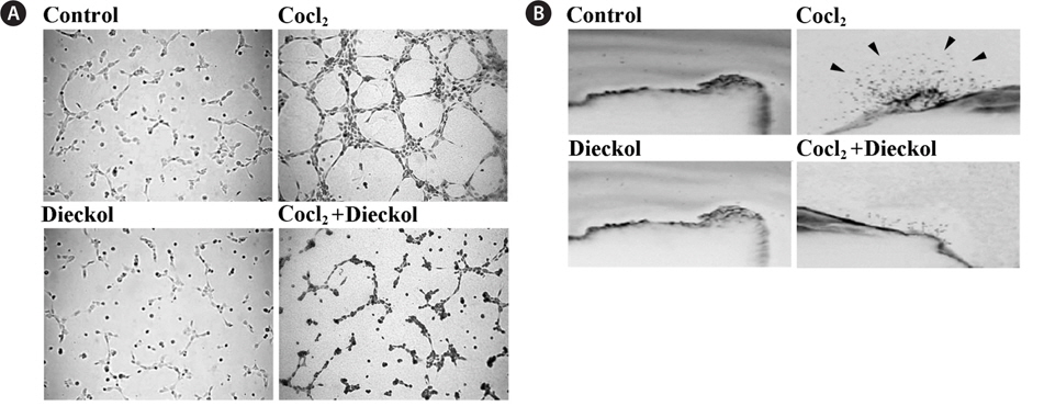 Dieckol inhibits CoCl2-induced tube formation in vitro and aortic ring sprouting ex vivo. A, HUVECs were incubated in medium with 1% FBS for 12 h, replated on Matrigel-coated plates at a density of 2 × 105 cells/well, and then incubated in the absence or presence of 100 μM CoCl2 and 25 μM dieckol. After 16 h, the cultures were photographed. Representative endothelial tubes are shown; B, Aortas in Matrigel were treated with 100 μM CoCl2 in the absence or presence of 25 μM dieckol and stained with Diff-Quick on day 6. Representative aortic rings were photographed.