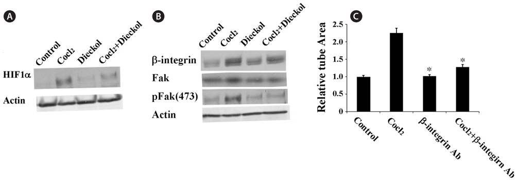 Dieckol attenuates CoCl2-induced expression of hypoxia-inducible factor 1-alpha (HIF1α) and β1-integrin. A, HUVECs were incubated in the absence or presence of 100 μM CoCl2 and 25 μM dieckol for 24 h and then harvested for western blotting; B, HUVECs in Matrigel were pretreated with a β1-integrin-neutralizing antibody (200 ng/mL) for 30 min before incubation with CoCl2 for 16 h, and tube formation was induced and then photographed. The area covered by the tube network was quantitated using Image-Pro Plus Software. Experiments were repeated and the presented values are means of triplicates. PBS-treated cells were used as a control. ？, P < 0.05 compared with CoCl2.