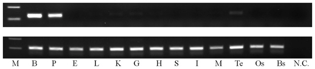 Tissue distribution of of-pMCH in olive flounder Paralichthys olivaceus by RT-PCR. N.C. represents the negative control. Arrow indicates the expected size of pMCH (390 bp) (B: brain, P: pituitary, E: eye, L: liver, K: kidney, G: gill, H: heart, S: stomach, I: intestine, M: muscle, Te: testis, Os: ocular skin, Bs: blind skin, N.C.: negative control).