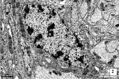 Neurosecretory cell in the pars intercerebralis of first instar larva of Antheraea mylitta showing nucleus (N), nuclear membrane (NM), plasma membrane (PM), mitochondria (MT), endoplasmic reticulum (ER), canaliculi (C).