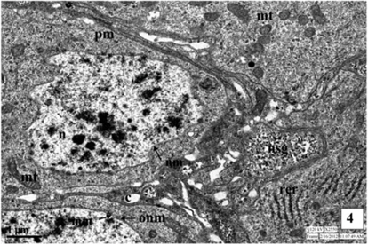 Neurosecretory cell in the pars intercerebralis of second instar larva of A. mylitta showing nucleus (N), nuclear membrane (NM), outer nuclear membrane (ONM), inner nuclear membrane (INM), plasma membrane (PM), rough endoplasmic reticulum (RER), mitochondria (MT), neurosecretory granules (NSG) and canaliculi (C).