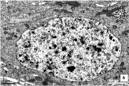 Neurosecretory cell in the pars intercerebralis of third instar larva of A. mylitta showing nucleus (N), outer nuclear membrane (ONM), inner nuclear membrane (INM), endoplasmic reticulum (ER), mitochondria (MT), neurosecretory granules (NSG) and canaliculi (C).