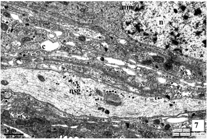 Neurosecretory pathways in the pars intercerebralis of third instar larva showing nucleus (N), nuclear membrane (NM), canaliculi (C) and transport of neurosecretory granules (NSG).