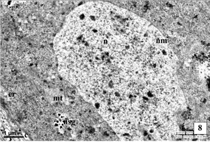 Neurosecretory cell in the pars intercerebralis of fourth instar larva of A. mylitta showing nucleus (N), nuclear membrane (NM), endoplasmic reticulum (ER), mitochondria (MT), neurosecretory granules (NSG) and canaliculi (C).