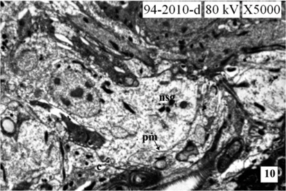 Neurosecretory cell showing the release of neurosecretory granules of fifth instar larva of A. mylitta showing nucleus (N), neurosecretory granules (NSG), canaliculi (C).