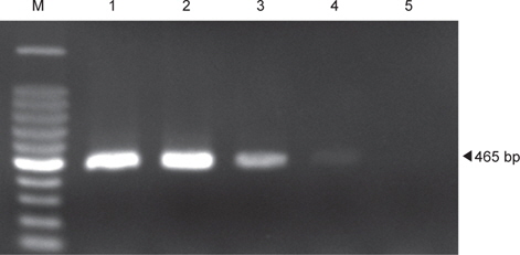 Agarose gel electrophoresis of DNA products amplified in PCR assay using hns primers. M, 100 bp ladder marker (Takara, Japan); lane 1, 0.8×10⁴CFU; lane 2, 0.8×10³ CFU; lane 3, 0.8×10² CFU; lane 4, 0.8×10¹ CFU; lane 5, 0.8×100 CFU.