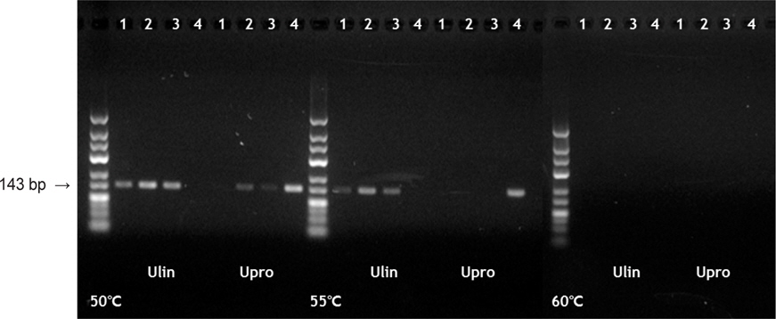 rbcL region PCR products using Ulva species specific primers [Samples (1-3 'Parae-gim', 4 'Gamtae-gim')]. Forward primers [Ulin: U. linza specific primer (rbcL-448Fms1-Ulin), Upro: U. prolifera specific primer (rbcL-448Fms1-Upro)].