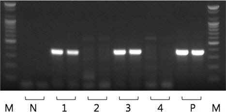 28S rDNA PCR result of Kudoa septempunctata targetting 356 bp size. PCR was performed as duplicate. Lane 1 and 3 show K. septempunctata positive results and lane 2 and 4 show K. septempunctata negative results. M, 100 bp marker; N, negative control; P, positive control.