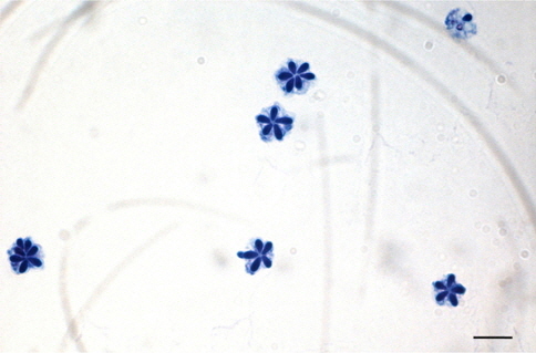 Kudoa septempunctata spores stained by Loffler’s methylene blue solution, havaing 5-7 polar capsules. Scale bar = 10 μM.
