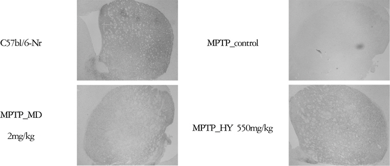 Effects of Hyangsayangwi-tang on the immunohistochemistry of TH-immunoresponsive (TH-IR) neurons in the striatum (ST) in the MPTP-induced Parkinson's disease (PD) mice