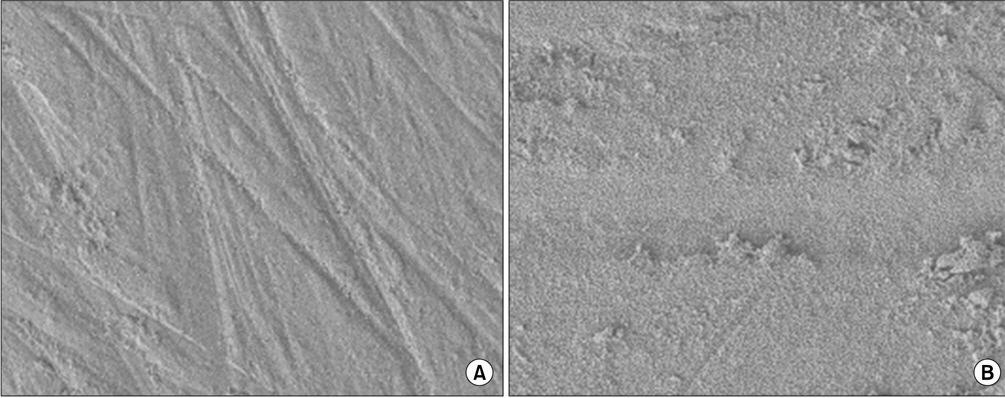 SEM images show zirconia surface textures (×250). (A) No etching zirconia group, (B) zirconia group with etching.