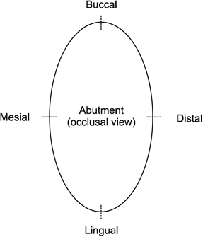 Occlusal view of abutment (dotted line: measurement part).