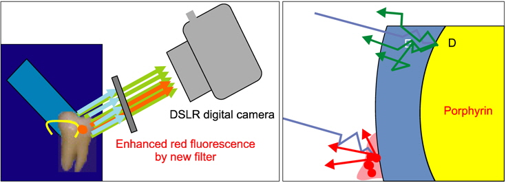 The principle of Quantitative Light-Induced Fluorescence-Digital to detect the red fluorescence.