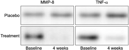 Comparison of matrix metalloproteinase (MMP)-8 and tumor necrosis factor (TNF)-α expression in the gingival crevicular fluid between the two groups by western blot.