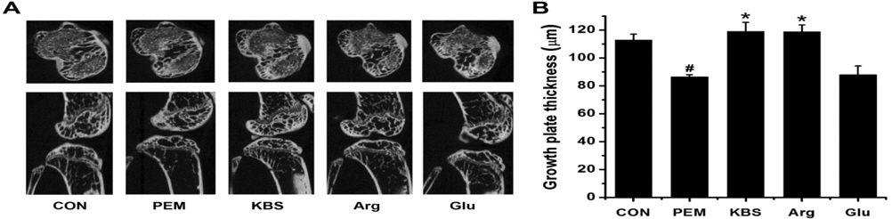 Effect of KBS on tibial growth plate thickness. (A) Representative 3D μCT images of knee joint showing growth plate. (B) The thickness of excised bone growth plate was determined on five points using the Sky Scan 1076. CON, adequate protein diet + DW-administered group; PEM, low protein diet + DW-administered group; KBS, low protein diet + KBS-administered group; Arg, low protein diet + Arg-administered group; Glu, low protein diet + Glu-administered group. Each datum represents the mean ± SEM of three independent experiments. #p < 0.05; significantly different from the CON value. *p< 0.05; significantly different from the PEM value.