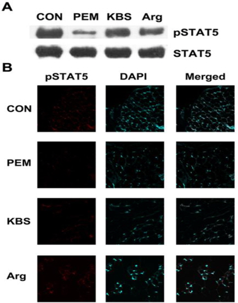 Effect of KBS on the phosphorylation of STAT5. (A) Liver tissues of each mouse were homogenized and analysed for pSTAT5 and STAT5 by Western blot analysis using specific anti-pSTAT5 and STAT5 antibodies as described in the experimental procedures. (B) pSTAT5 was analyzed by immunohistochemistry in the tibia. CON, adequate protein diet + DW-administered group; PEM, low protein diet + DW-administered group; KBS, low protein diet + KBS-administered group; Arg, low protein diet + Arg-administered group.