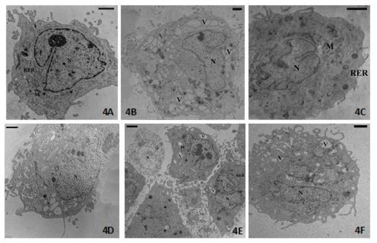 TEM micrographs of human OA chondrocytes: (A) DW-DMEM, controls: the cell shows a good state of health. (B) Incubation with IL-1β (5 ng/ml): Vacuolization (V) of the cytoplasm and reduction in quality of Golgi bodies, rough endoplasmic reticulum (RER) and mitochondria (M). (C) 25% or 50% VW-DMEM: not particular morphological alterations. (D) 100% VW-DMEM: Altered status of chromatin and of cytoplasm structure. Normal plasma membrane and nucleus (N). (E) 25% or 50% VW-DMEM with IL-1β: The cell partially restores its morphology. Euchromatic nucleus (N), restored organization of cytoplasm [vacuoles (V) very reduced, abundant rough endoplasmic reticulum (RER), well shaped mitochondria (M)]. Plasma membrane with cytoplasmic processes. (F) 100% VW-DMEM with IL-1β: Vacuoles (V), reduction of cytoplasmic organelles, and nucleus (N). Bar = 1 μm (from Fioravanti et al., 2013).