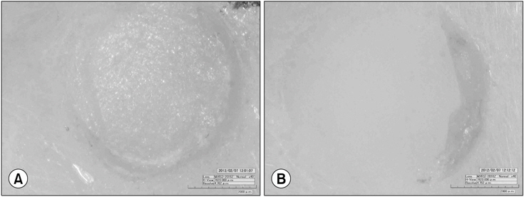 Representative images of the zirconia core surface (microscope images, ×160). (A) Cohesive failure, (B) mixed failure.