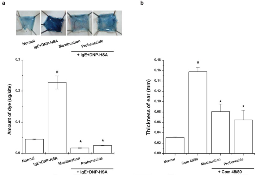 Effect of moxibustion and probenecid in allergic animal models. (a) Mice were intradermally injected with 100 ng of anti-DNP-IgE. Probenecid (300 mg/kg) was administered intraperitoneally for 1 h prior to challenge with 1 mg/ml of antigen (DNP-HSA) containing 4% Evans blue (1:1) via the tail vein after 48 h and then moxibustion applied after 5 min. The amount of effused dye from PCA skin was evaluated. (b) Probenecid (300 mg/kg) was intraperitoneally administered 1 h prior to compound 48/80 application. 20 μl of compound 48/80 was intradermally applied before moxibustion. All data represents the mean ± S.D. #p < 0.05, significantly different from the normal group; *p < 0.05, significantly different from the compound 48/80 group or IgE-DNP-HSA group. n = 6.