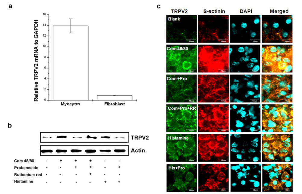 Probenecid suppresses compound 48/80-induced TRPV2 expression in cardiomyocytes. Embryonic cardiomyocytes and fibroblasts from the heart were analyzed using quantitative real-time PCR analysis for TRPV2. (a) The mRNA expression of TRPV2 in fibroblast and cardiomyocytes. The cells were pretreated with ruthenium red (2 μM) for 20 min before compound 48/80, histamine (100 μM), or probenecid (100 μM) stimulation. The expression of TRPV2 protein was analyzed using Western blot analysis (b) and immunocytochemistry analysis (c). The TRPV2+ (FITC) and sarcomeric-α actinin+ (TRITC) cells were examined with a confocal laser-scanning microscope. Representative photomicrographs were examined at 60 × magnification. (Scale bar = 10 μm). Com 48/80, compound 48/80, Com + Pro, compound 48/80 + probenecid; Com + Pro + RR, compound 48/80 + probenecid + ruthenium red; His + Pro, histamine + probenecid.