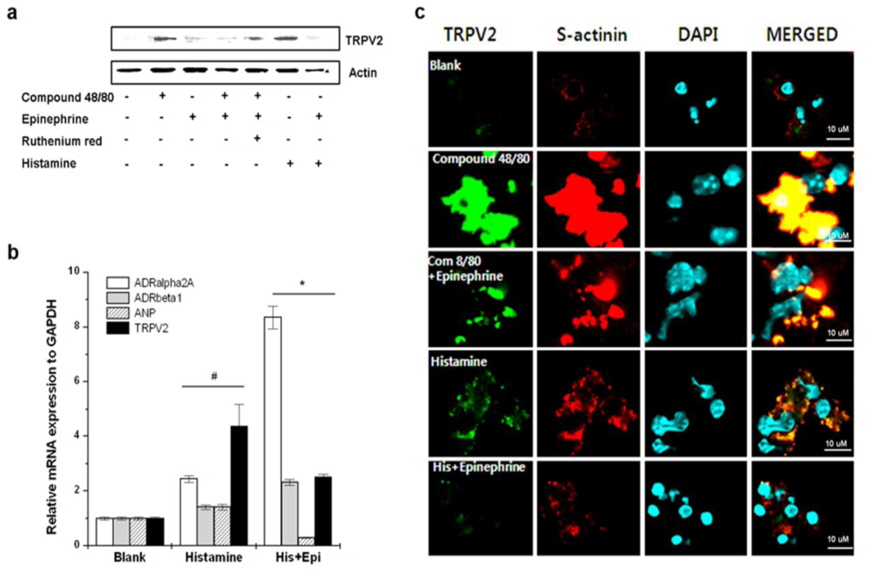 Epinephrine suppresses compound 48/80-induced TRPV2 expression in cardiomyocytes. Embryonic cardiomyocytes from the heart were isolated and the cells pretreated with ruthenium red (2 μM) for 20 min before compound 48/80, histamine (100 μM), or epinephrine (5 nM) treatment. (a) The expression of TRPV2 protein was analyzed using Western blot analysis. (b) Quantitative real-time PCR analysis for TRPV2, ANP, ADRα2A, and ADRβ1. Data represents the mean ± S.D. (c) Immunocytochemistry analysis. The TRPV2+ (FITC) and sarcomeric-α actinin+ (TRITC) cells were examined with a confocal laser-scanning microscope. The merged image indicated the colocalization of cardiomyocytes and TRPV2. Representative photomicrographs were examined at 60 × magnification. (scale bar = 10 μm). His + Epi, histamine + epinephrine. #p < 0.05, significantly different from the blank group; *p < 0.05, significantly different from the histamine group.