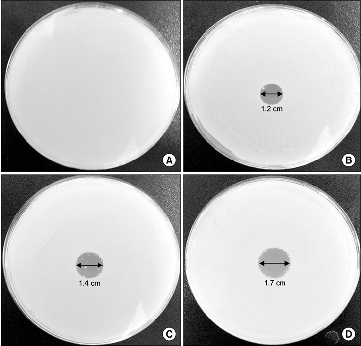 The plasma treatment of the agar plates caused growth inhibition zone of Candida albicans. The agar plates were exposed to the 900 MHz microwave plasma jet for (A) 0 sec (without plasma treatment), (B) 60 sec, (C) 180 sec, (D) 300 sec and then incubated at 37℃ for 24 hours.