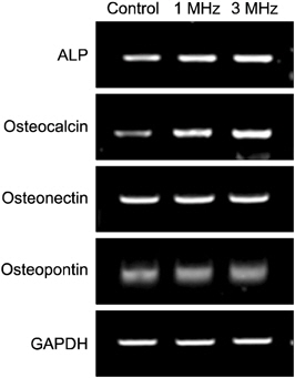 The results of reverse transcription-polymerase chain reaction analysis. Expression of alkaline phosphatase (ALP), osteocalcin, osteonectin and osteopontin during the osteoblastic differentiation of MG-63 cells. GAPDH: glyceraldehyde 3-phosphate dehydrogenase.