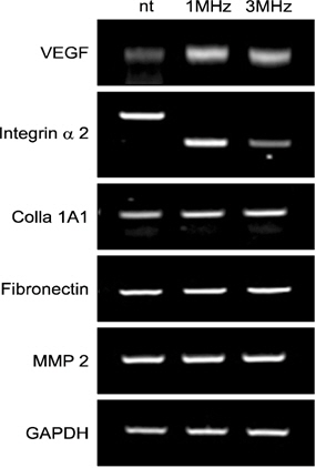 The results of reverse transcription-polymerase chain reaction analysis. Expression of vascular endothelial growth factor (VEGF), integrin α2, colla 1A1, fibronectin and matrix metalloproteinase (MMP) 2 during the osteoblastic differentiation of MG-63 cells. GAPDH: glyceraldehyde 3-phosphate dehydrogenase.