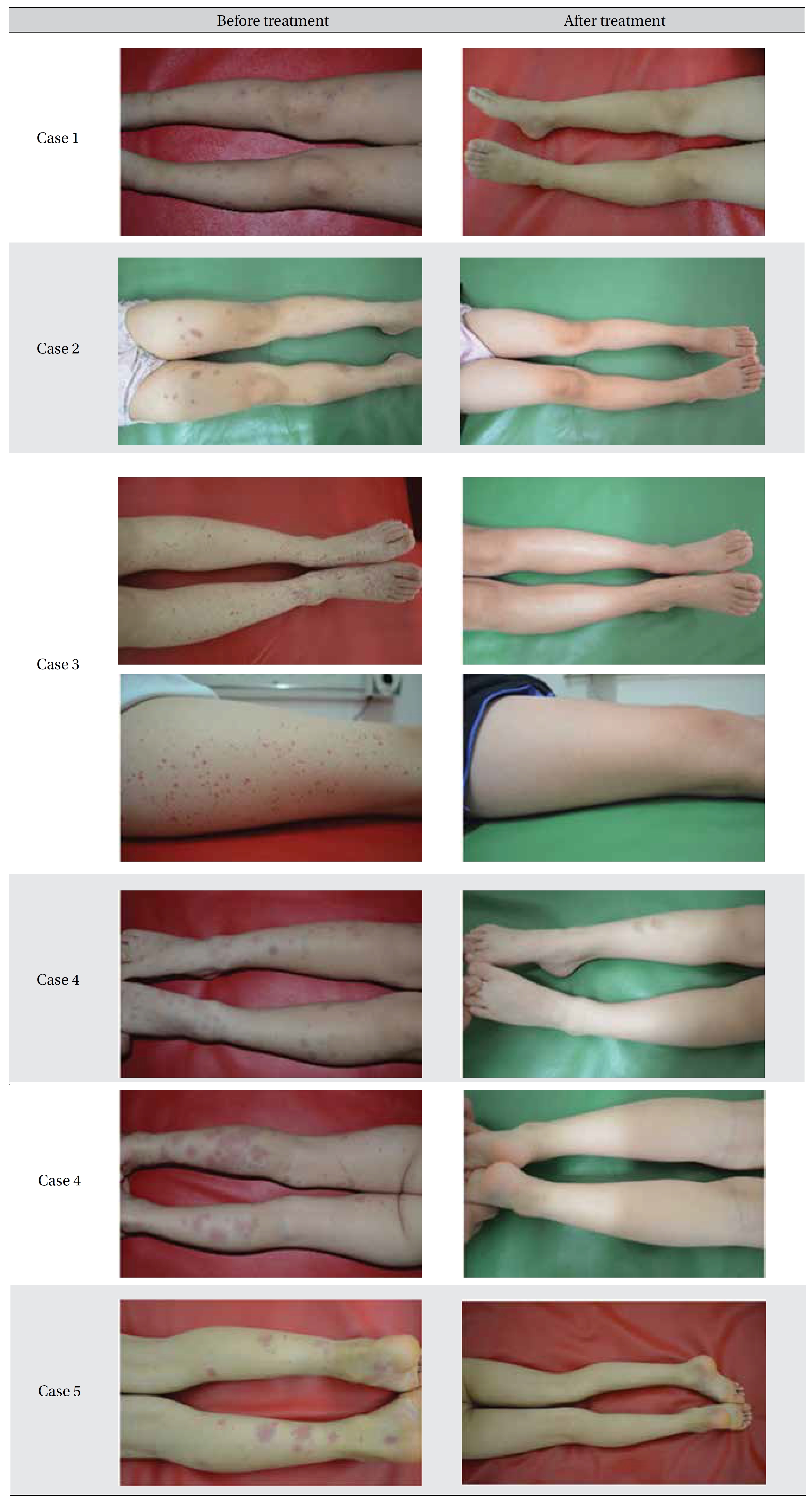 Images before and after treatment