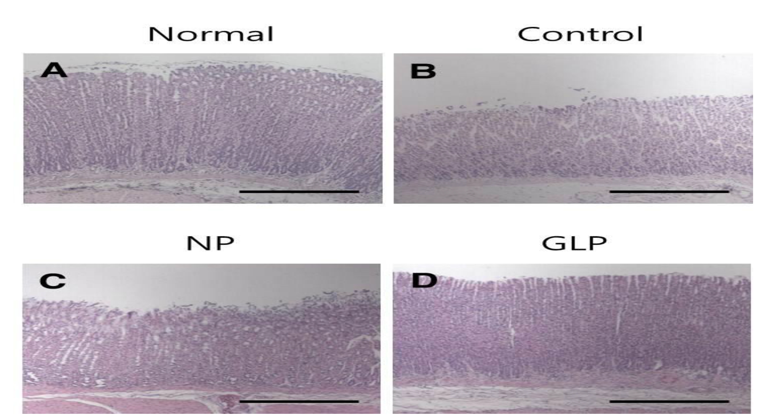 Light microscopic images of EtOH-induced chronic ulcers in rats.