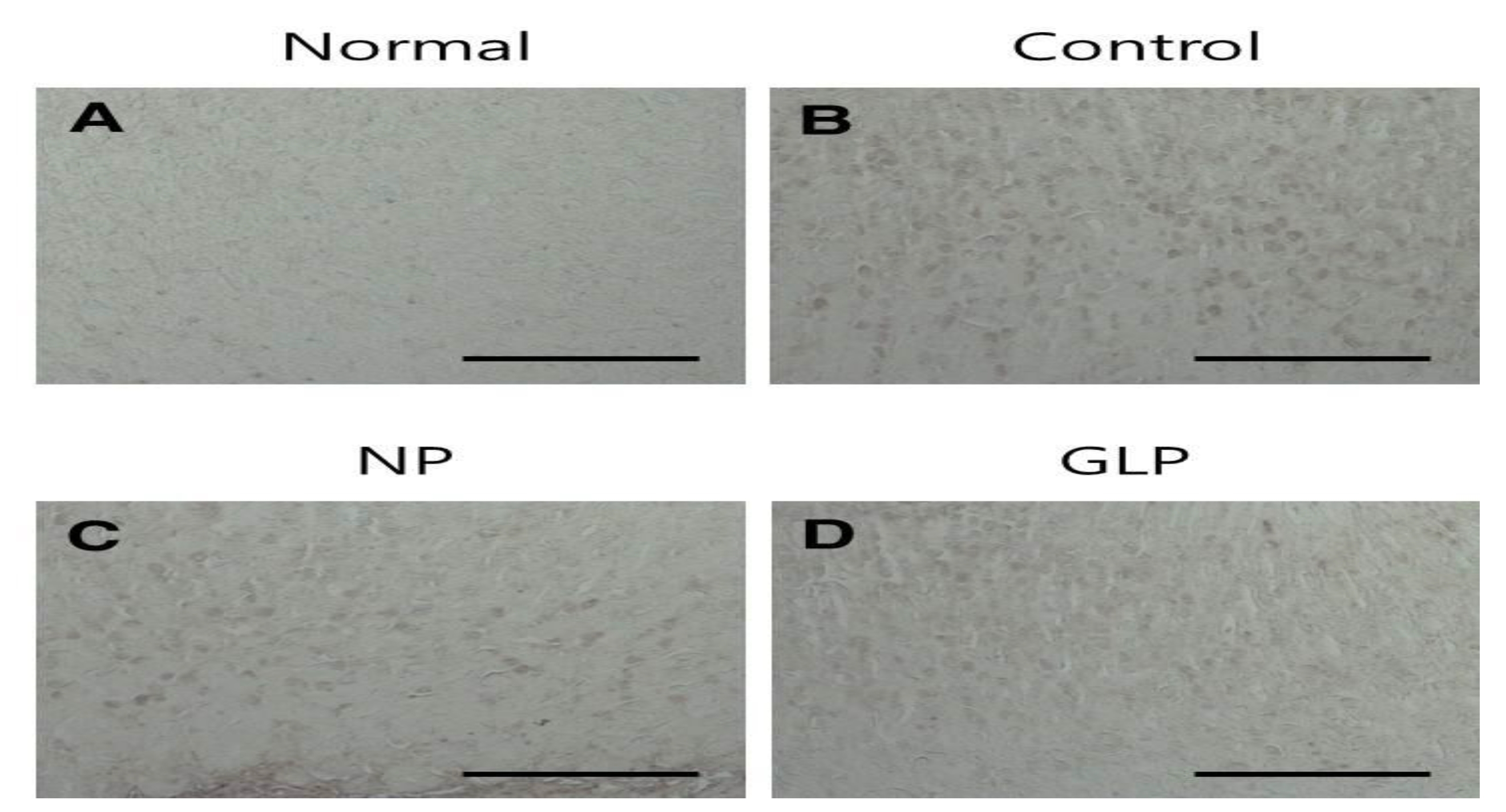 Immunohistochemical staining of BAX proteins in EtOH-induced chronic gastric ulcers in rats.