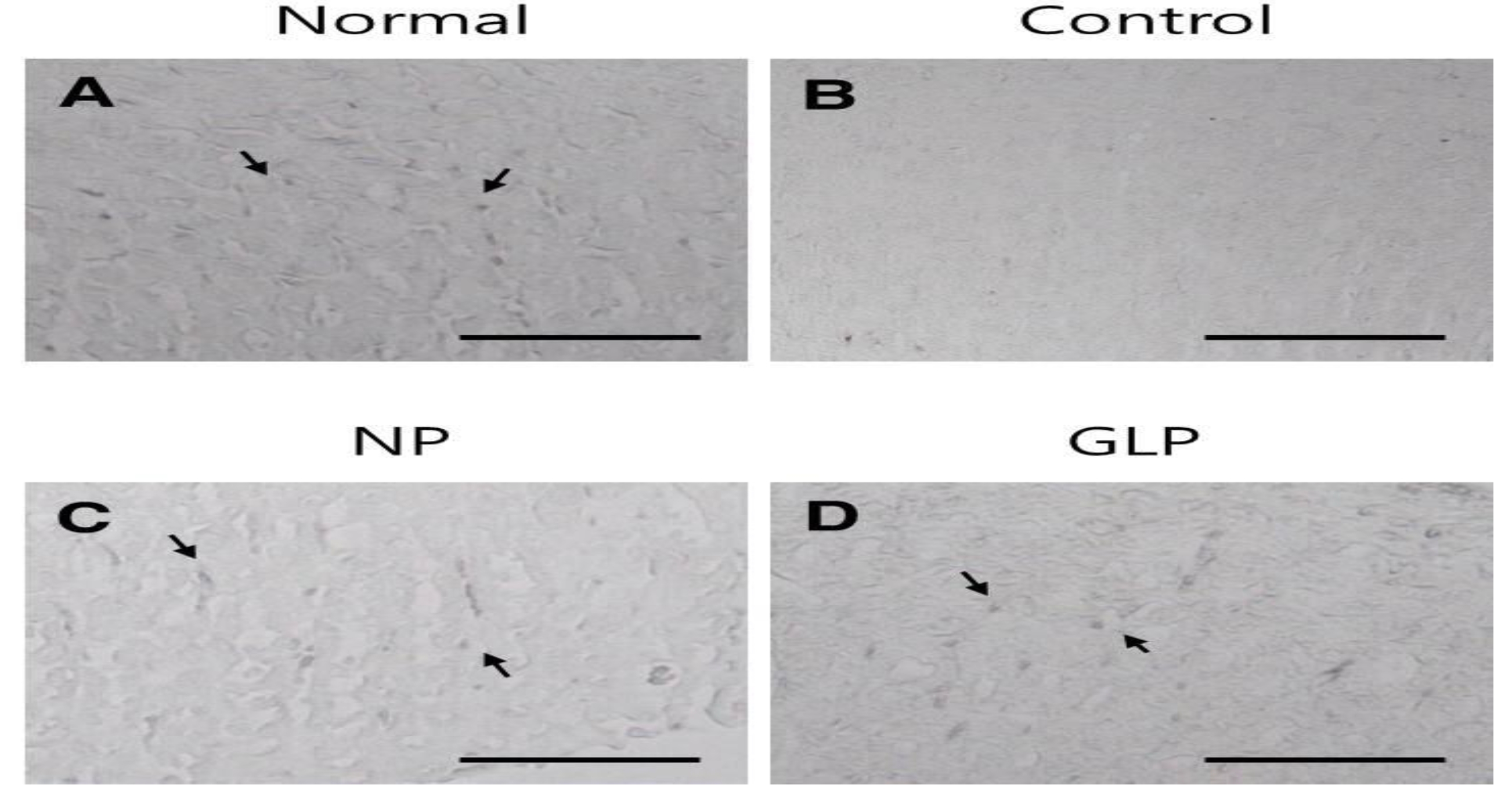 Immunohistochemical staining of Bcl-2 proteins in EtOH-induced chronic gastric ulcers in rats.