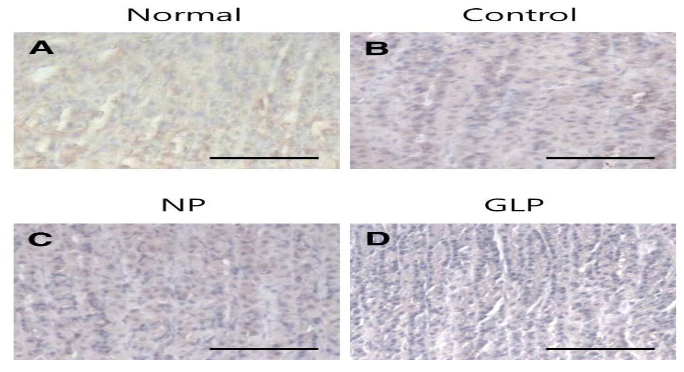 Immunohistochemical staining of TGF-β1 proteins in EtOH-induced chronic gastric ulcers in rats.