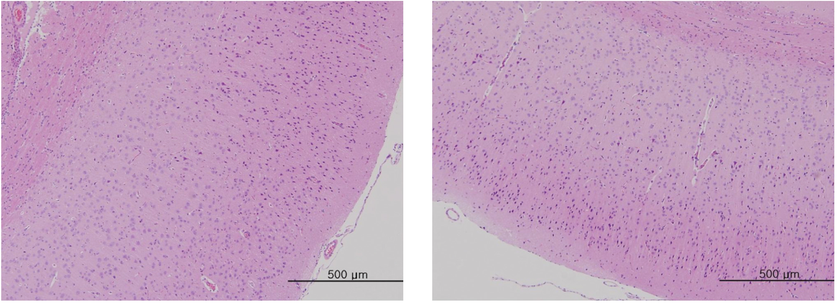The tissue of the brain from an intramuscular single-dose toxicity study of ginseng pharmacopuncture in Sprague-Dawley Rats. No histopathological change was detected by hematoxylin & eosin staining (× 200, × 200).