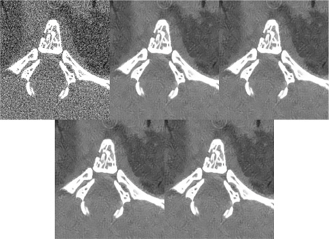 The real, low dose image on the abdomen of mouse and output images of the filters from to bottom from left right, real, low dose image, guided filter, NLM filter, and proposed filter with single NEE and 3 NEEs.