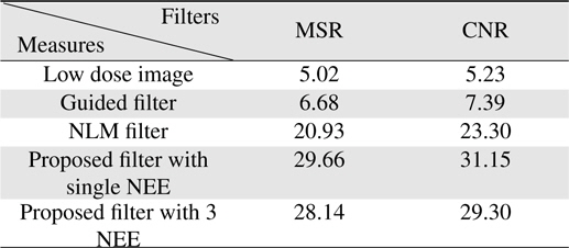MSR and CNR values for different filters and real, low dose image