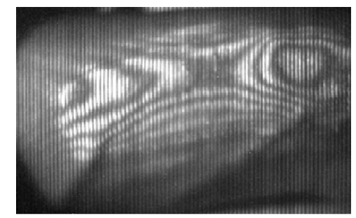 Moire pattern generated beneath the skin (45 degrees side view of the wrist).