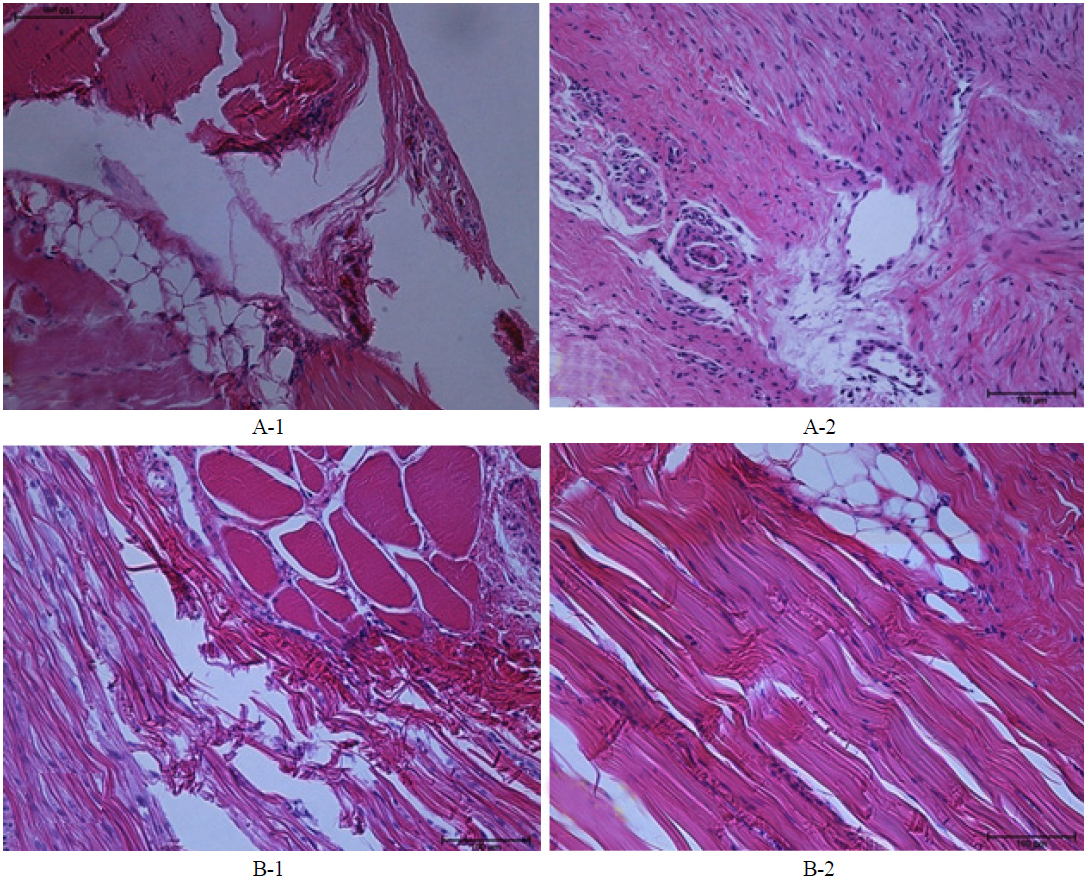 The histopathological findings for tendons from non-denervated and denervated rats. A-1: Non-denervated rat after the first week. A-2: Non-denervated rat after the second week. B-1: Denervated rat after the first week. B-2: Denervated rat after the second week. Scale bar: 100 μm.