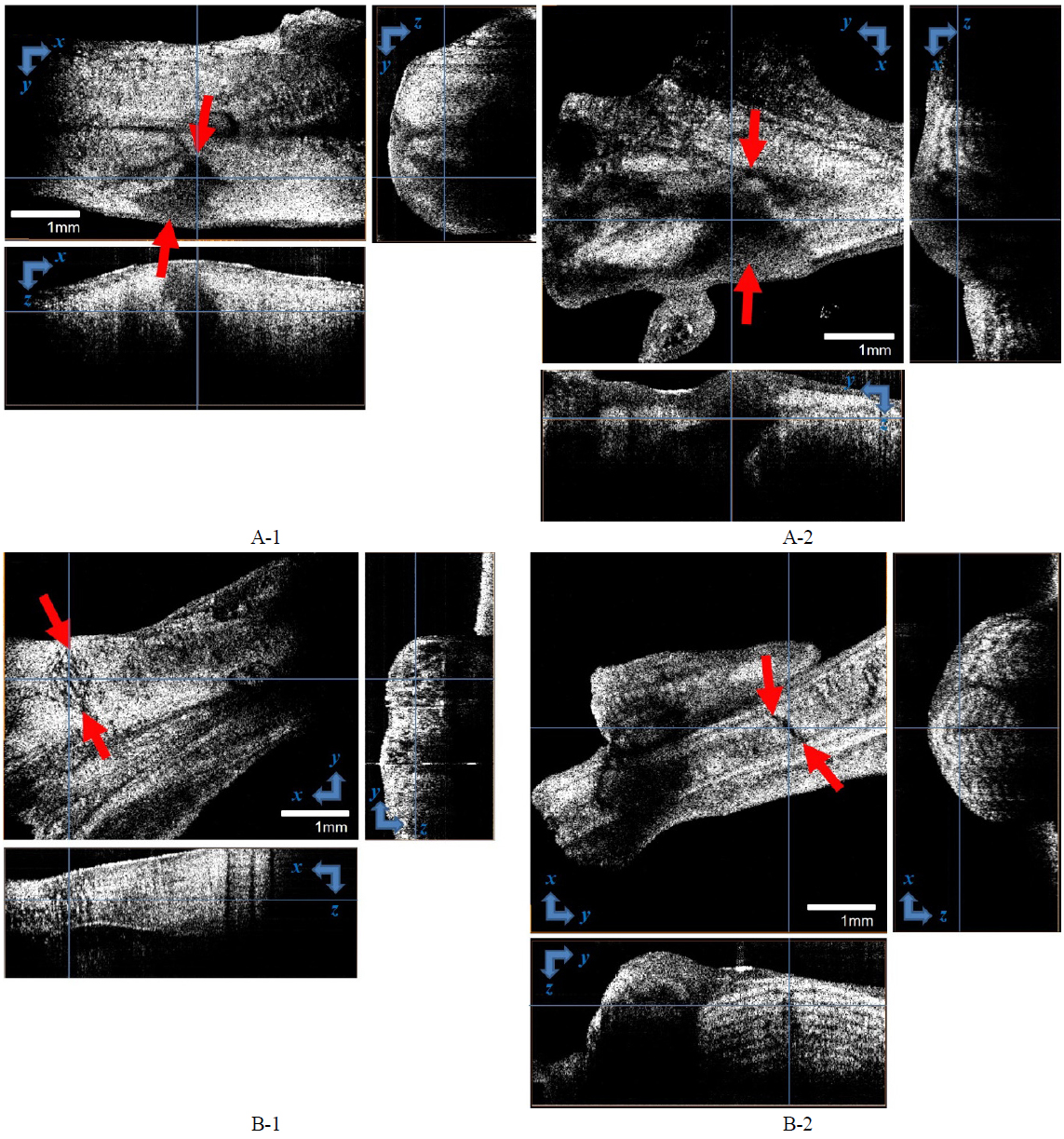 Threedimensional OCT findings for tendons of non-denervated and denervated rats. En face images (xy plane) were reconstructed from volume-rendered images. The red arrows correspond to the white arrows in Fig. 2A-1: Non-denervated rat after the first week. A-2: Non-denervated rat after the second week. B-1: Denervated rat after the first week. B-2: Denervated rat after the second week. Scale bar: 1 mm.