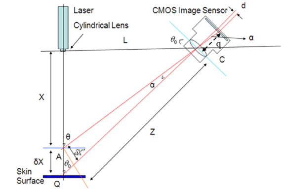Geometrical layout of the laser triangulation.