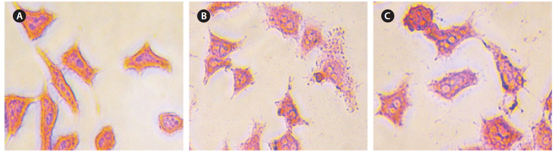 Prussian blue-stained HeLa cells after 48-h treatment with CS-cisplatin-Fe3O4 NPs. Control cell (A), 25 μg/L concentration (B), and 50 μg/mL concentration (C).