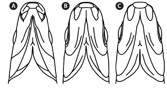 The shape of the mouth of a natural hybrid and its supposed parent species, Pungtungia herzi (♀) and Pseudorasbora parva (♂). A) Pu. herzi (♀), B) a natural hybrid and C) Ps. parva (♂).