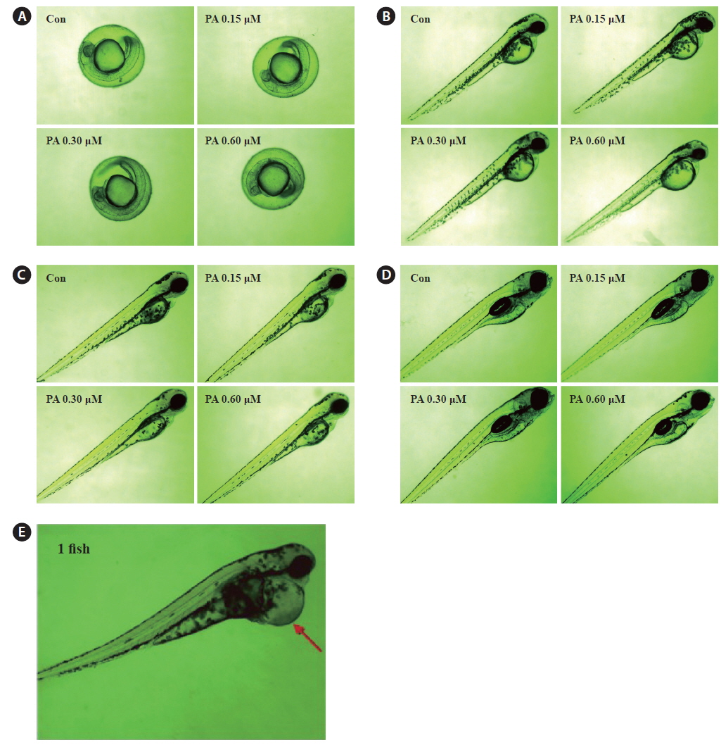 Morphology change of zebrafish by administration of PA during four days. Morphologies of zebrafish were observed at 1 day (A), 2 day (B), 3 day (C), and 4 day (D), respectively after treatment of PA (0.15 μ 0.60 μM). (E) edema picture of zebrafish at 4 day.
