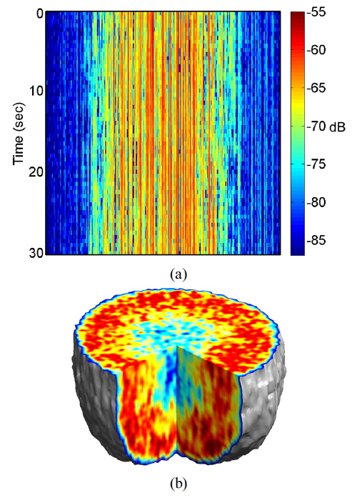 (a) Holographic intensity of a healthy tumor 750 μm in diameter, at a fixed depth of 350 μm along one spatial dimension (horizontal axis) as a function of time (vertical axis). (b) Reconstructed volumetric motility contrast image in the margins between each component. The zero-order of a healthy tumor spheroid 600 μm in diameter.